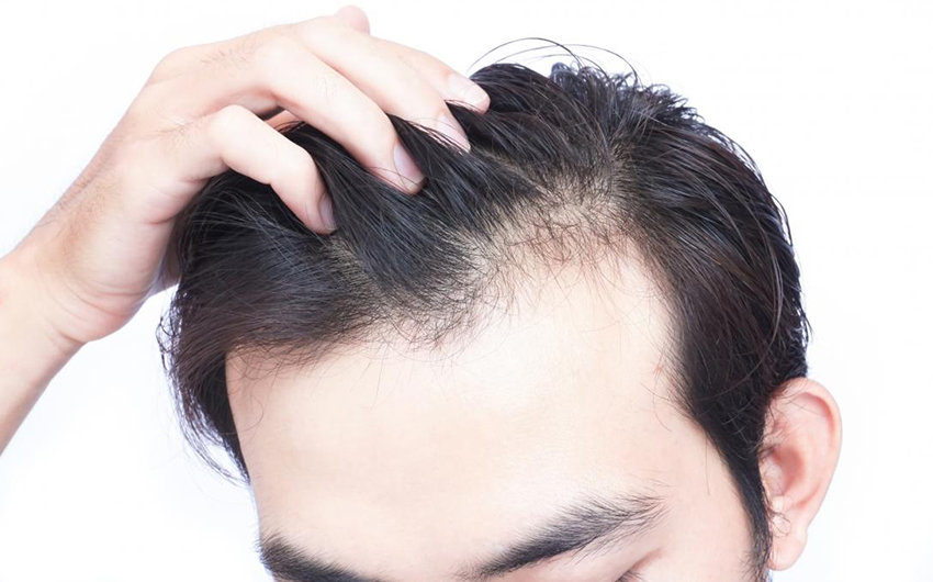 Hair Fall Treatment